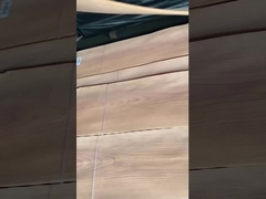 روکش تاج گیلاسی